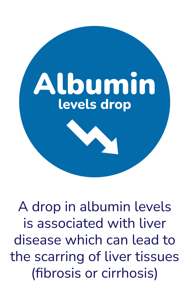 Albumin levels drop. A drop in albumin levels is associated with liver disease which can lead to the scarring of liver tissues (fibrosis or cirrhosis).